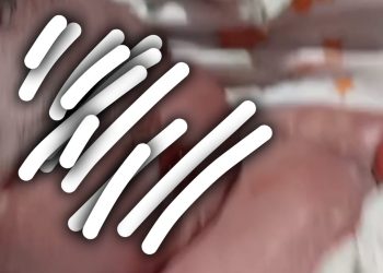 Bayi Dalam Kandungan Meninggal, Keluarga Korban Minta Dugaan Malpraktik Diusut